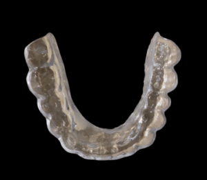 Appareil dentaire d’expansion