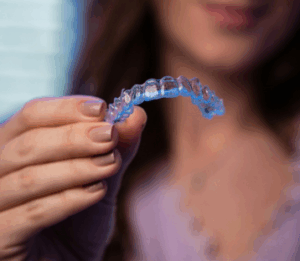 Appareil dentaire d’expansion