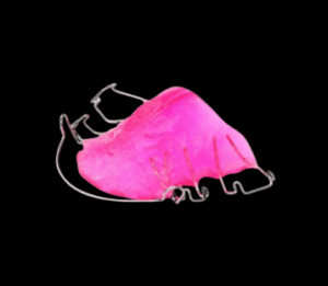 Appareil dentaire d’expansion